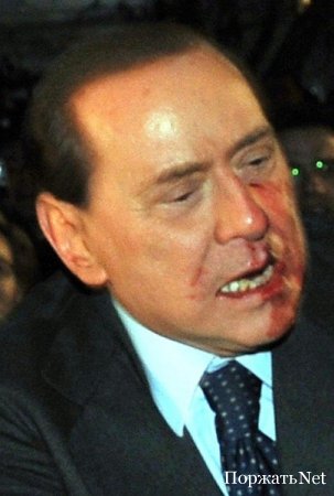 Сильвио Берлускони сломали нос и выбили несколько зубов.