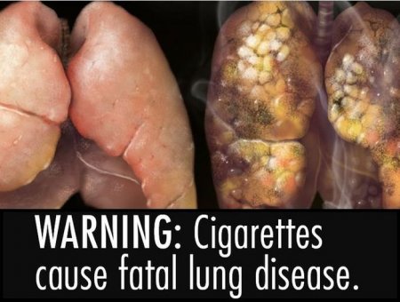 Предупреждение о вреде курения на пачках сигарет со всего мира