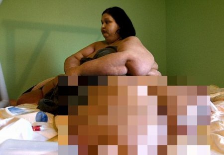   "Полутонная убийца " Майра Розалес похудела на 350 кг