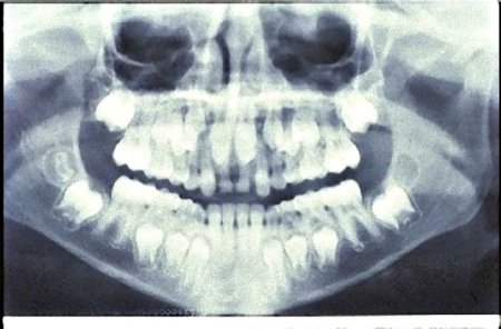 Занимательная стоматология