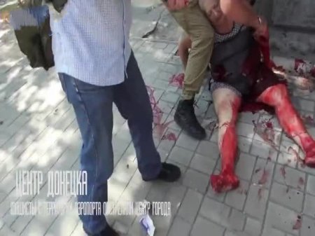 Раненая женщина в Донецке***