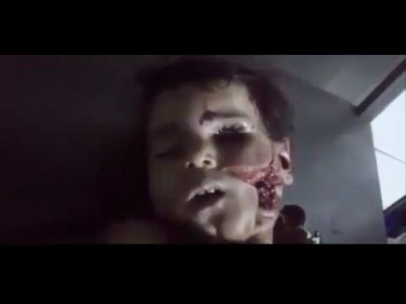 Боль сирийцев